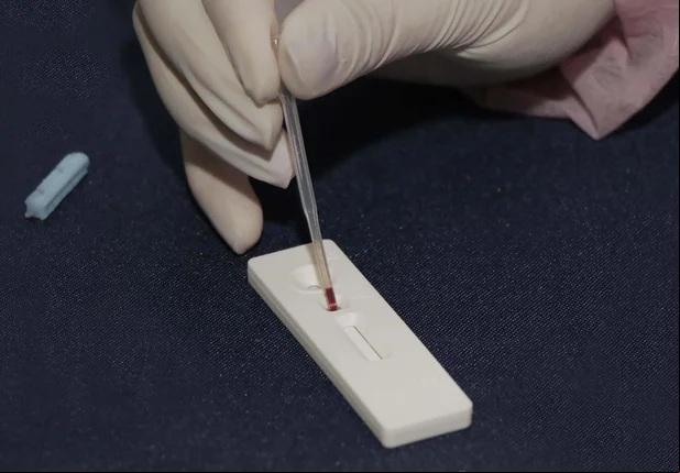 Teste coronavírus